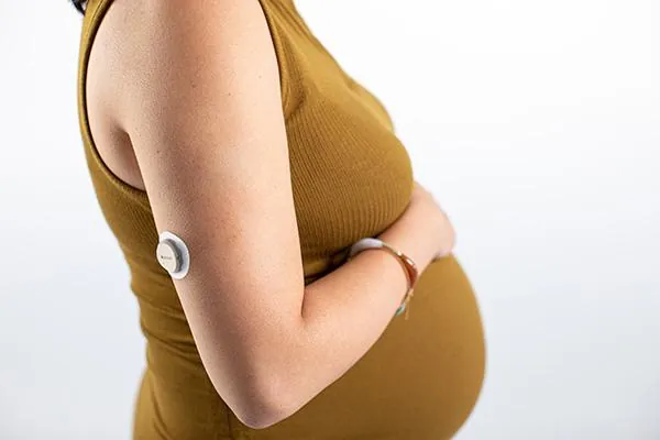 Gestante com sensor contínuo de glicose no braço